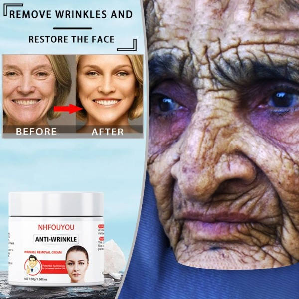 Retinol løftende krem herding fjerner rynker anti-aldring blekner fine linjer ansiktsbleking
