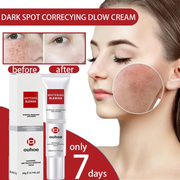 Mørk plet hud hvidning fade creme oplysning pletter fjernelse reducerer alder pletter fregner ansigt creme