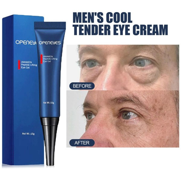Anti aldring øyekrem reduserer øye rynker retinol anti aldring krem