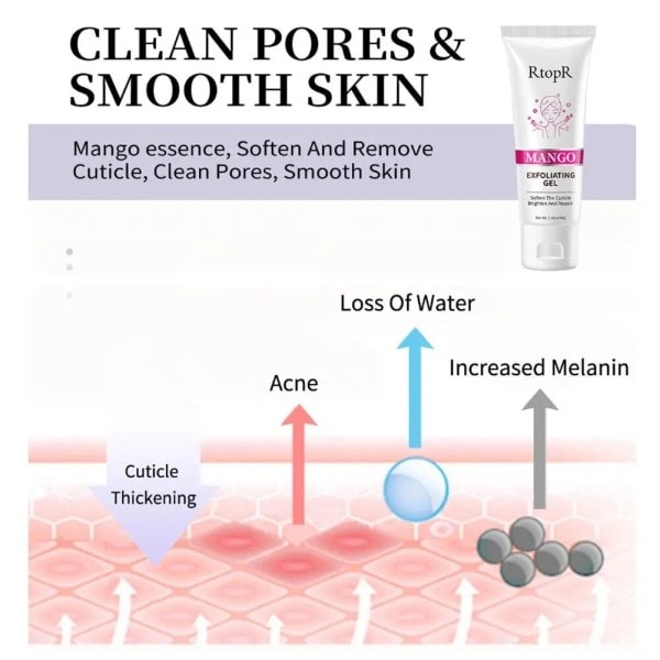 Ansigt eksfolierende creme hudpleje blegning fugtighedscreme reparation ansigtsscrub renser acne blackhead behandling fjern ansigt creme