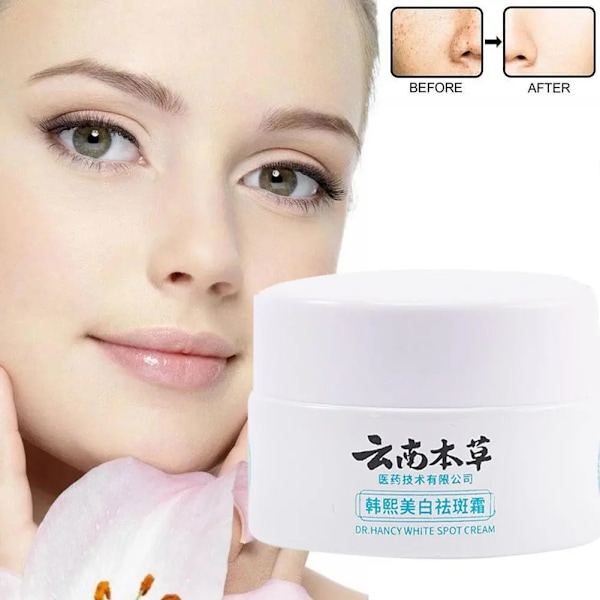 Urte Whitening Freckle Fjerning Cream Spot Fading Fade Plekker Reparation Cream Face Cream Hudpleie Produkter 20g