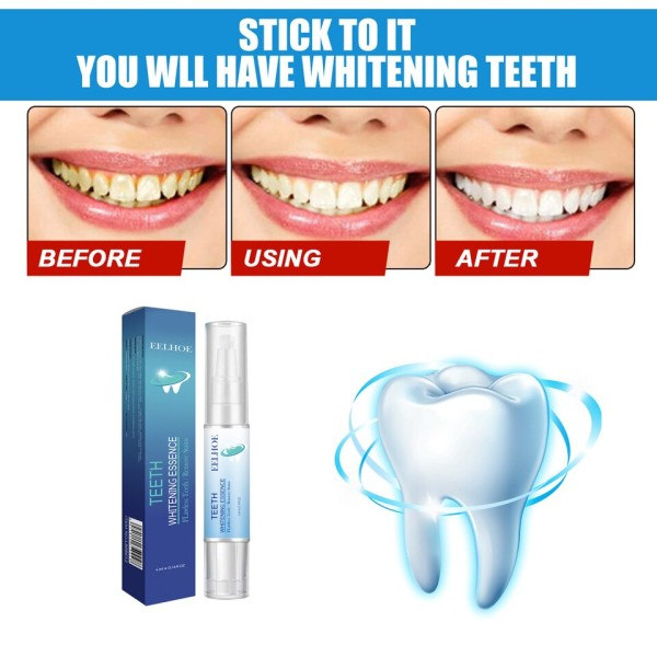 Tennene bleking penn tann gel blekemiddel blekemiddel fjerne flekker øyeblikkelig smil tenner bleking sett