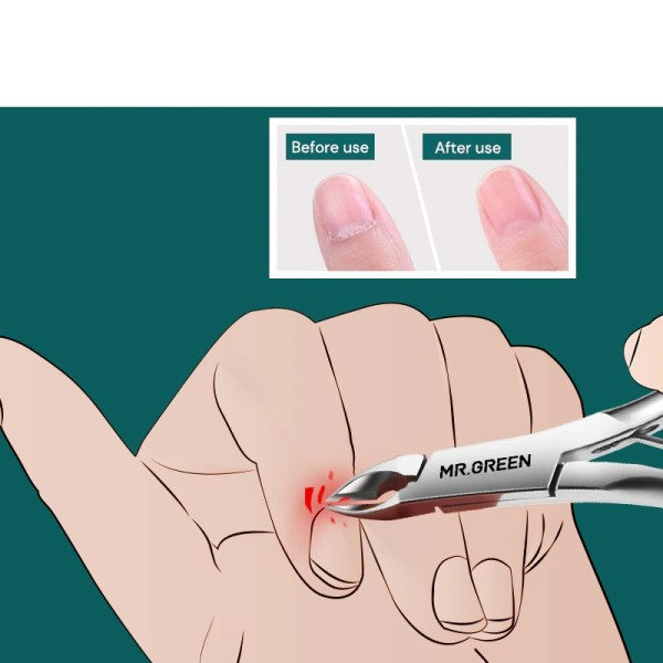 Cuticle Nippers Negle Manicure Cuticle Saks Clippers Trimmer Død Skin Fjerner Pedicure Rustfrit Stål Skærer Værktøj