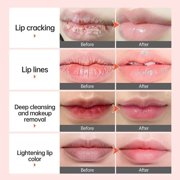 Bubble Lightening Mørk Læbe Balme Maske Langvarig Fugtgivende Exfoliante Reducer Læbe Linjer