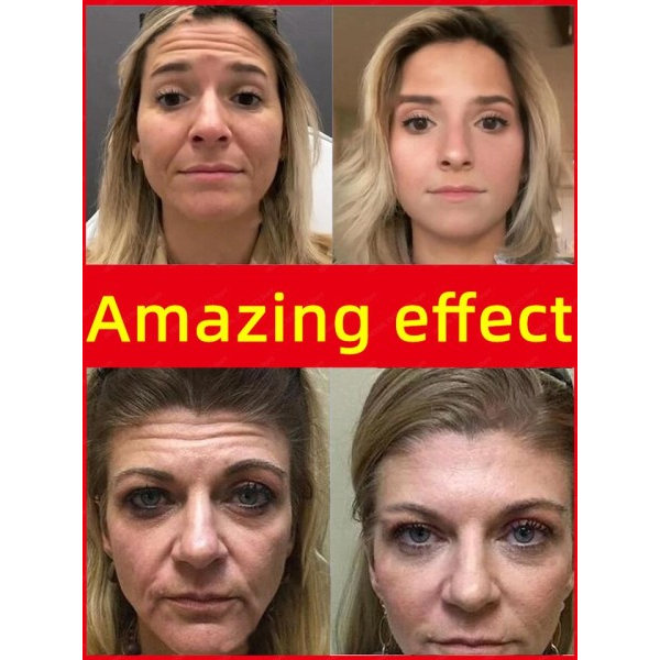 Rynke fjerner ansigt serum løftning opstrammende fade fine linjer anti-aldring essens