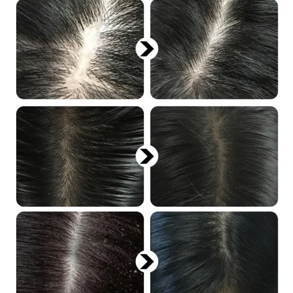 Naturlig kokosnød olie hår vækst shampoo hårtab behandling
