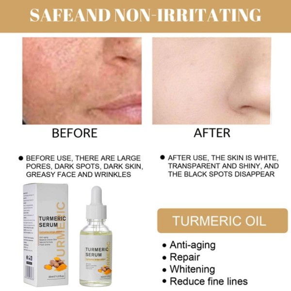 Gurkemeje Fregne Hvidning Olie Serum Curcumin Olie Brighten Farmed Mørke Pletter Fjernelse
