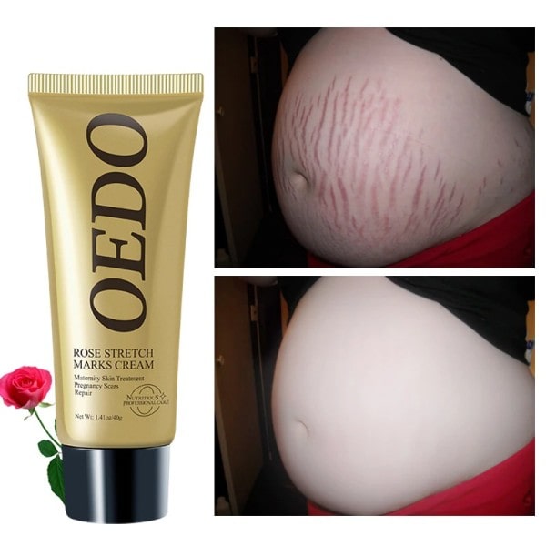Rose fjerner stretch mærke creme for at fjerne reparation anti-aldring anti-blinker opstrammende body creme
