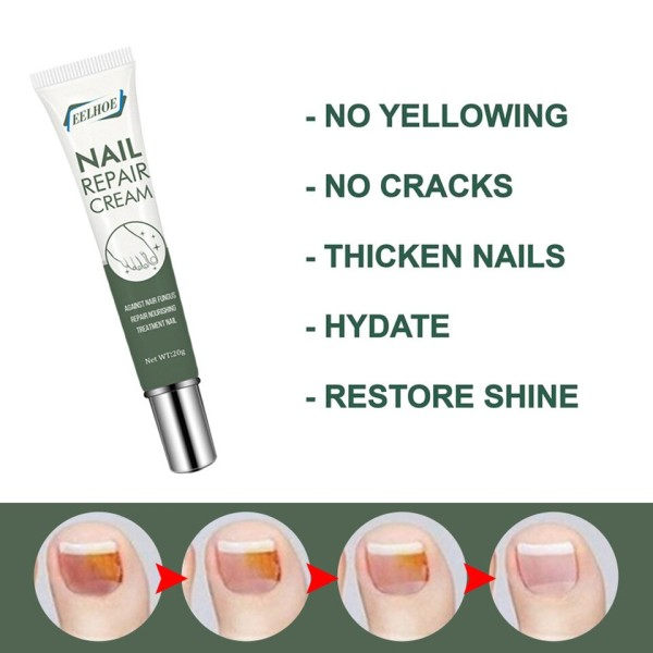 Reparation creme Hurtig fjernelse af grå negle reparation neglepleje salve fortykkelse blød negle creme