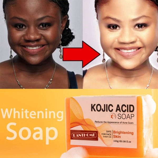 Whitening Tvål Hud Lightening Tvålar Lightening Skin Lighten Mörka Fläckar Handgjord Tvål 5 bitar
