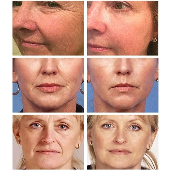 Magic Wrinkle Remover Face Cream Anti-Aging Fade Fine Lines Lifting Firming Whitening Fuktgivande Skönhet Hudvård 50g