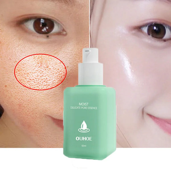 Krymp porer Bli av pormaskar Acne Ljusna upp hudton ansiktsbehandling serum