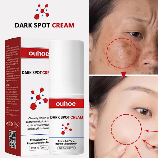 Ta bort Mörka Fläckar Snabb Ljusna upp Förbättra Matthet  Effektiv Bletning Freckles Hudvård