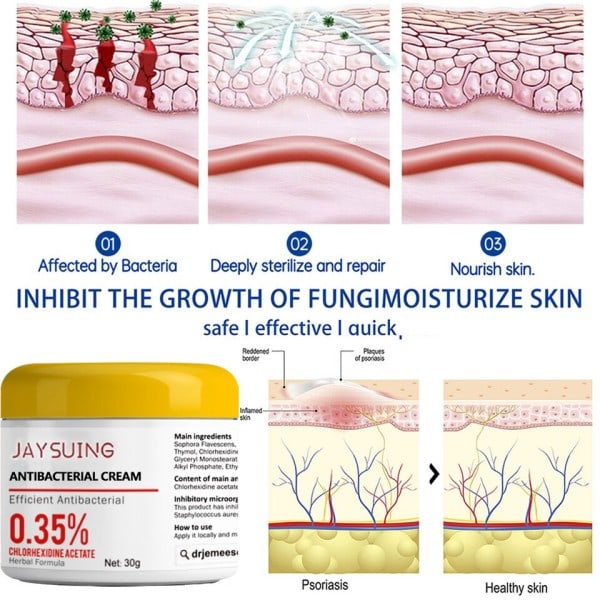 Återfuktande kräm naturlig reparation antibakteriell lindrar exfolierar torr hud kliande grov hud vård