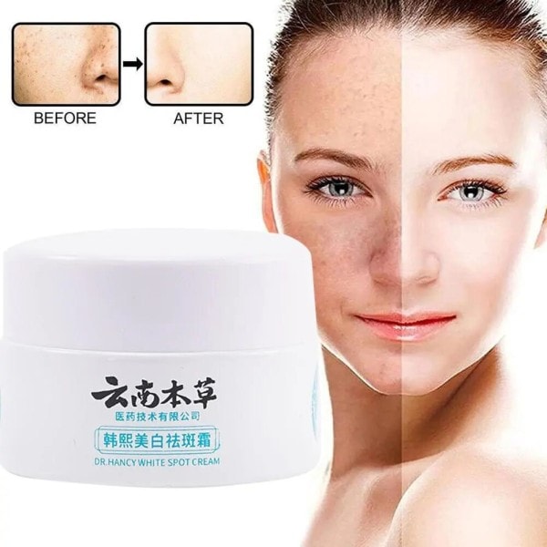 Urte Whitening Freckle Fjerning Cream Spot Fading Fade Plekker Reparation Cream Face Cream Hudpleie Produkter 20g