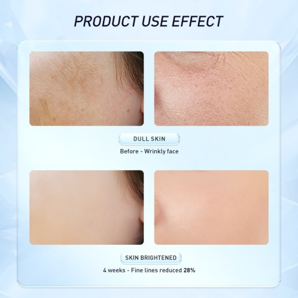 Retinol Ansikte kräm Anti-aging rynkor blekning Ljusare fuktgivande Ljusare fina linjer