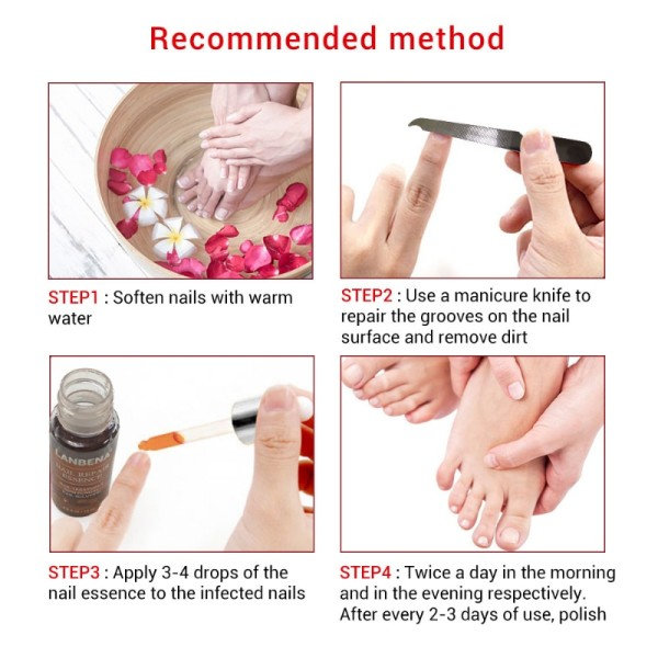 Negle svamp behandling essens serum hånd pleje fod svamp fjernelse reparation gel
