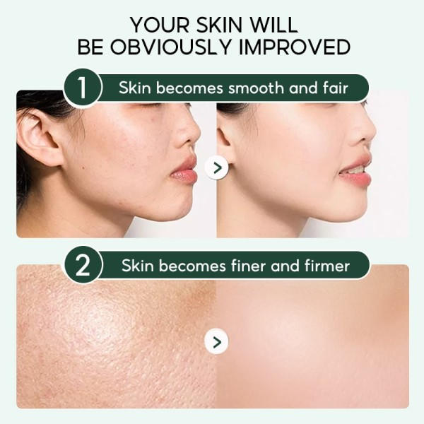 Pore Shrinking Serum Essence Porer Behandling Fugtgivende Lemper Tørhed Olie-kontrol