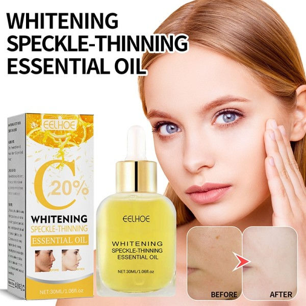 Spot Whitening Serum Lightening Lightening Hyperpigmentering Kloasma Mörka Fläckar