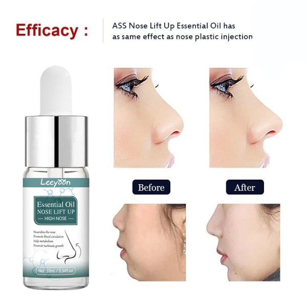 Næse Op Forhøjer Rhinoplastik Olie Næse Op Forhøjer Rhinoplastik Næse knogle