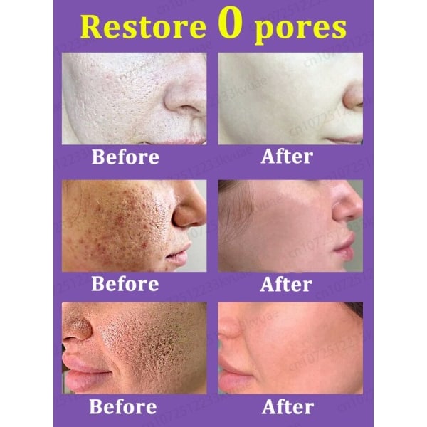 porer fjerner pore krympende serum krympe opstramning minimering