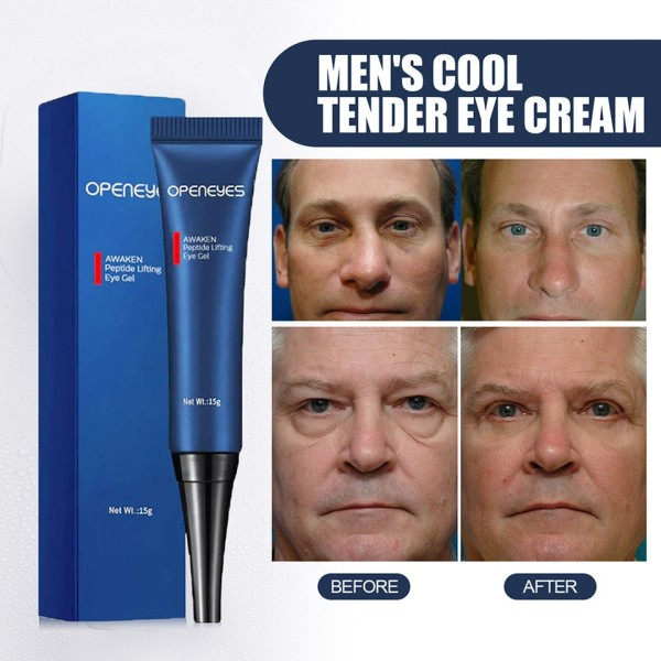 Anti aldring øyekrem reduserer øye rynker retinol anti aldring krem