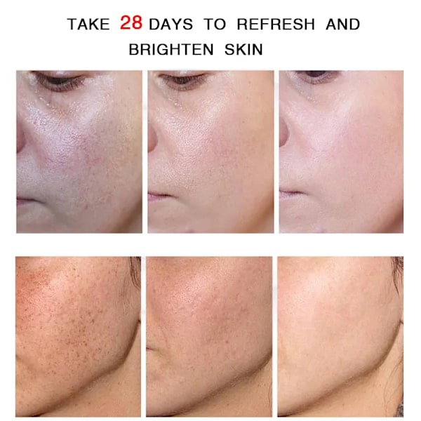 Blegning ansigt creme fjernelse rynker fregne fjernelse anti-acne behandling fade fine linjer