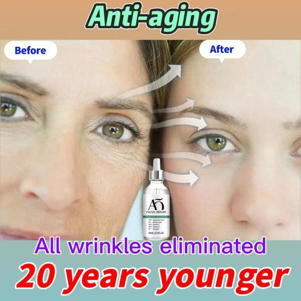 Lifting Opstrammende Creme Fjern Rynke Anti-Aging Fade Fine Linjer Ansigt Hvidning Lysere hud