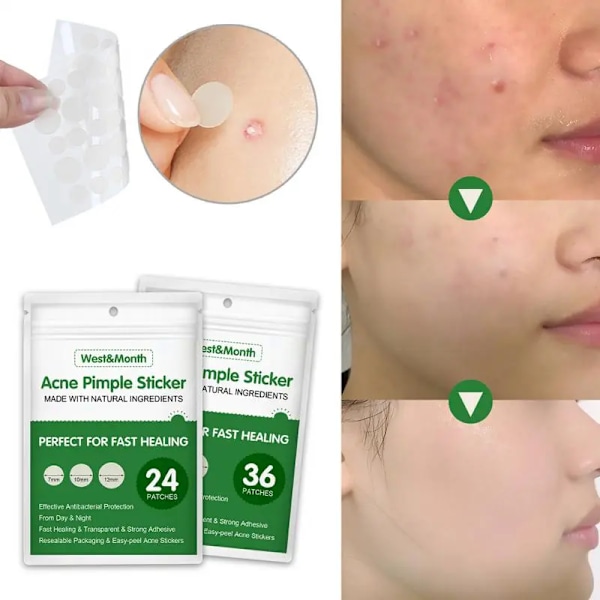 Acne Pimple Patch Osynlig Vattentät Absorbera Pus Acne Pimple Remover Verktyg Acne Cleaner