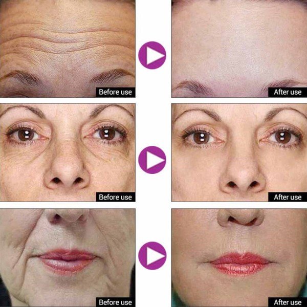 Fjern Rynker Face Serum Pro-Xylane Anti Aging Essence