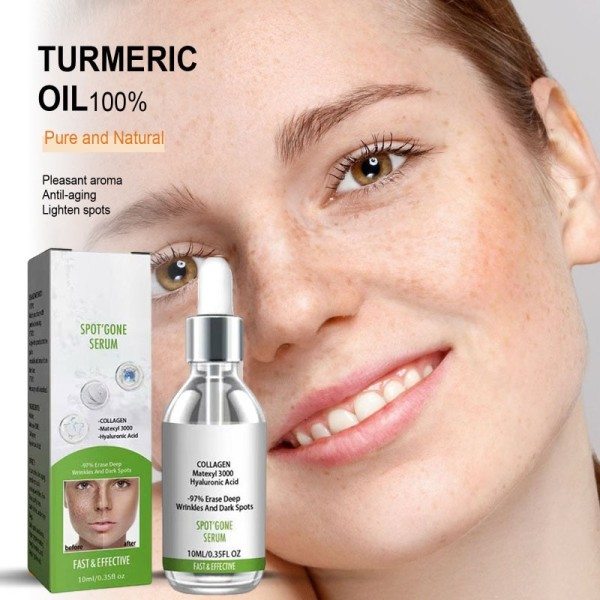 Anti mørke plet Fjern fregner chloasma hyperpigmentering blegning lys alder sol Melasma Kloasma Fjerner æterisk olie