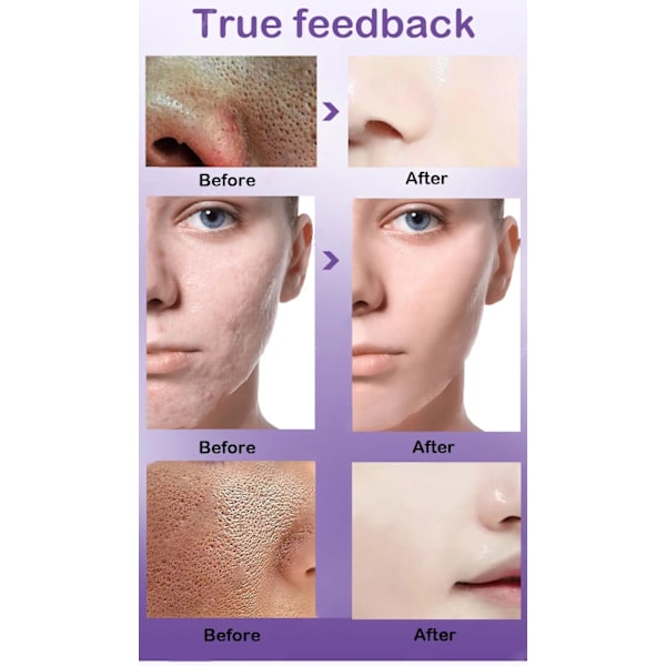 Pore Shrinking Serum Shrink Pores Cream Lactobionic Sur Shrink Pores Serum