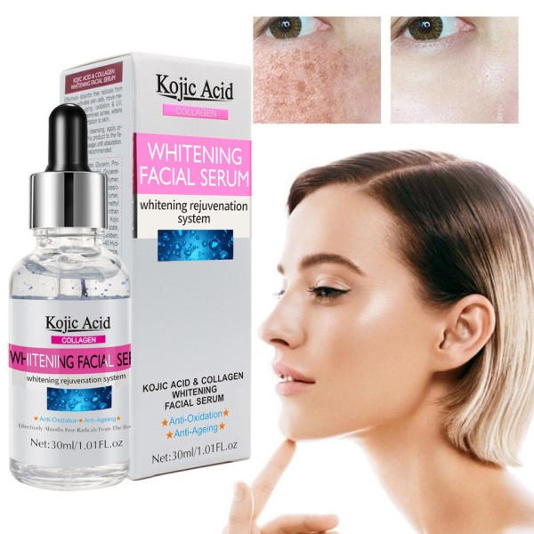 30ml Kojic Acid  Kasvohoito Seerumi valkaisu kirkastava kosteuttava parantaa karheutta vaalentaa täpliä kasvohoito esanssi