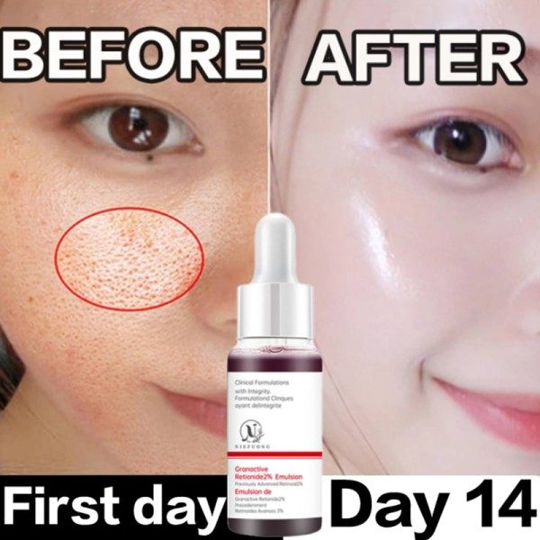 Pore Minimizer Serum För Ansikte Pore Ansiktsbehandling Porförträngande Serum