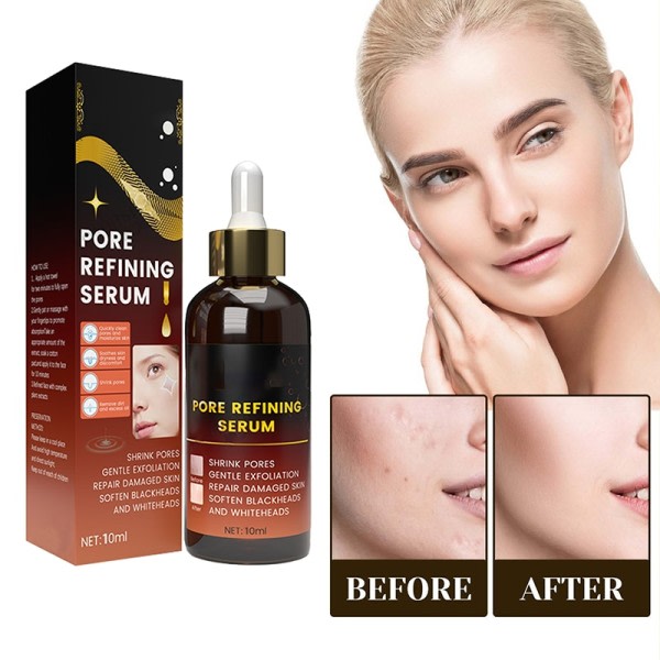 Effektiv porer fjerner pore krympe serum krympe oppstramming minimering