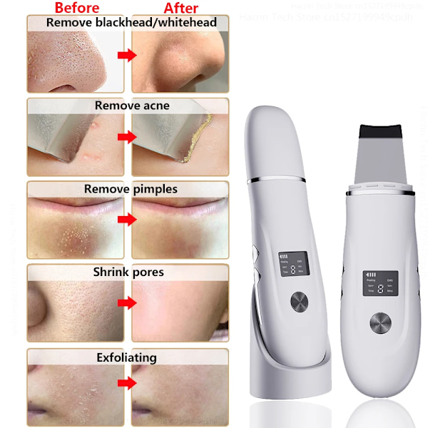 Ultraljud Peeling Remover Blackhead Ansikts Skin Scrubber Ansiktsbehandling Spad Djup rengöring Ansiktslyft Avlägsnande