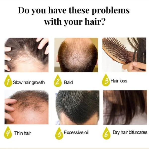 2 kpl riisi vesi shampoo saippua kiinteä hius kasvu shampoo patukka hius regrow shampoot