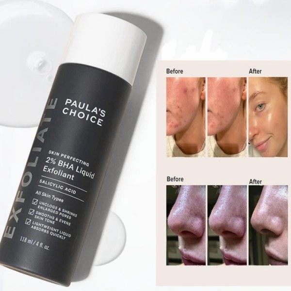 HUD PERFEKTERENDE 2 % BHA Væske Salicylsyre Exfoliant Ansigtsbehandling Eksfoliering til Hormehoveder Forstørrede porer rynker