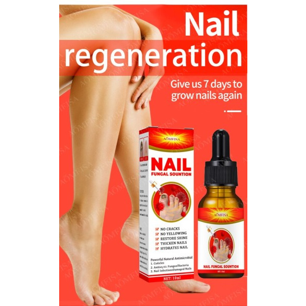 Svampe negle behandling olie fod reparation essens tå negle svamp fjernelse gel anti infektion creme svamp negle fjernelse