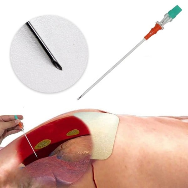 Rescue Tension Pneumothorax Access Kit Sterilized Body Piercing Sömnad Nålar