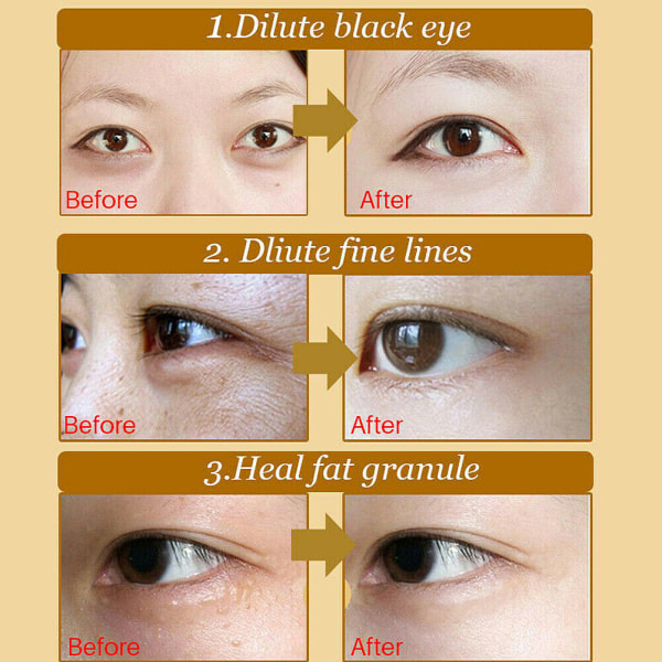 Under Eye Patches (30 Par) - Golden Under Eye Mask Collagen, Under Eye Mask til ansigt, mørke rande og hævelser, skønhed og personlig pleje