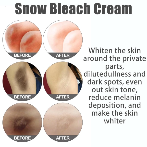 NYHET Crema de Blanqueamiento de Nieve para áreas Privadas, Crema de Blanqueamiento de piel Oscura para Cuello, Axilas, Rodillas och Codos