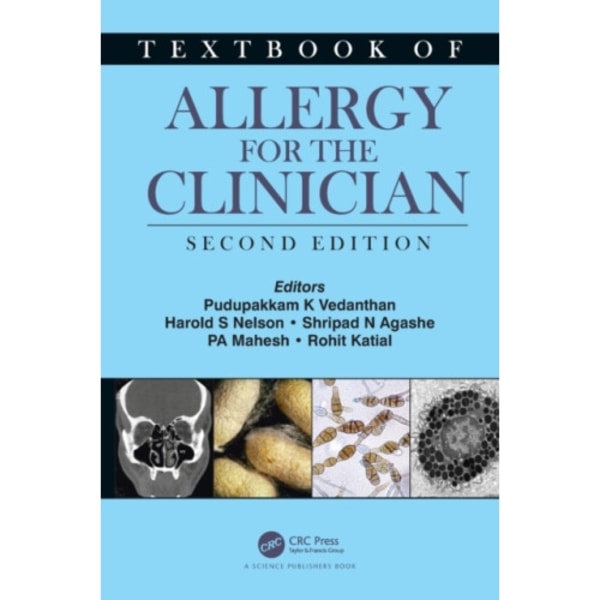 Textbook of Allergy for the Clinician (inbunden, eng)