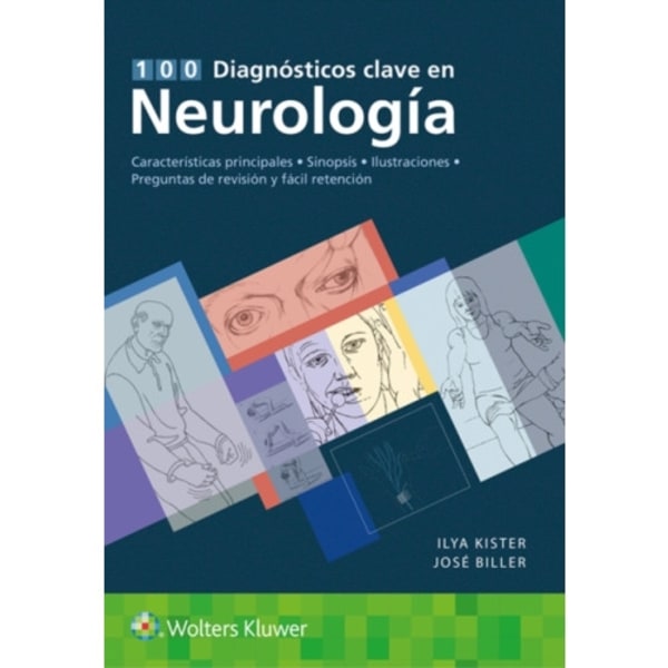 100 diagnosticos clave en neurologia (häftad, spa)