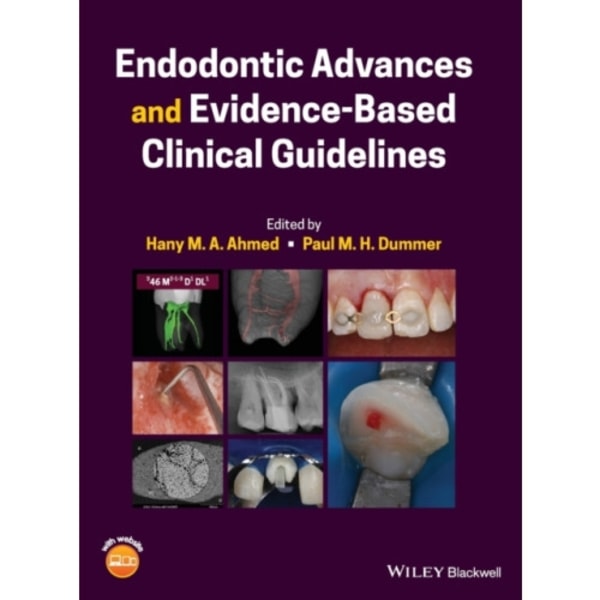 Endodontic Advances and Evidence-Based Clinical Guidelines (inbunden, eng)