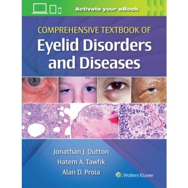Comprehensive Textbook of Eyelid Disorders and Diseases (inbunden, eng)