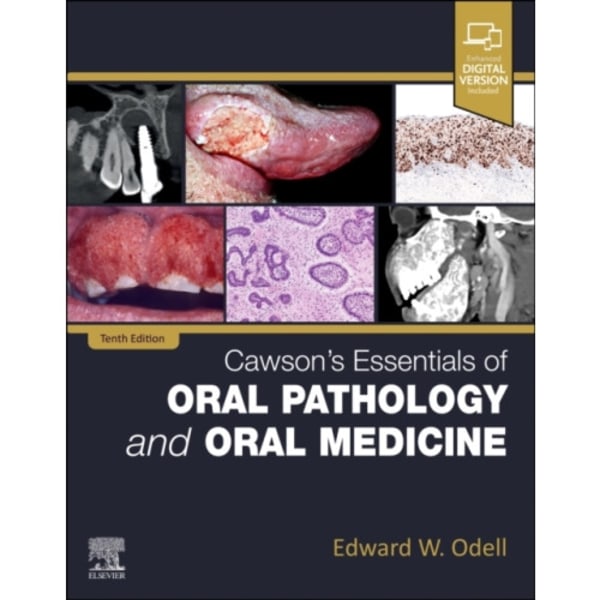 Cawson's Essentials of Oral Pathology and Oral Medicine (häftad, eng)