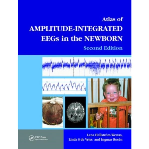 An Atlas of Amplitude-Integrated EEGs in the Newborn (inbunden, eng)