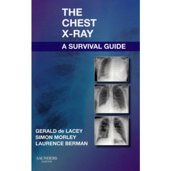 The Chest X-Ray: A Survival Guide (häftad, eng)