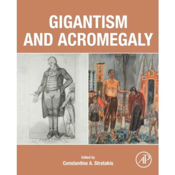 Gigantism and Acromegaly (häftad, eng)